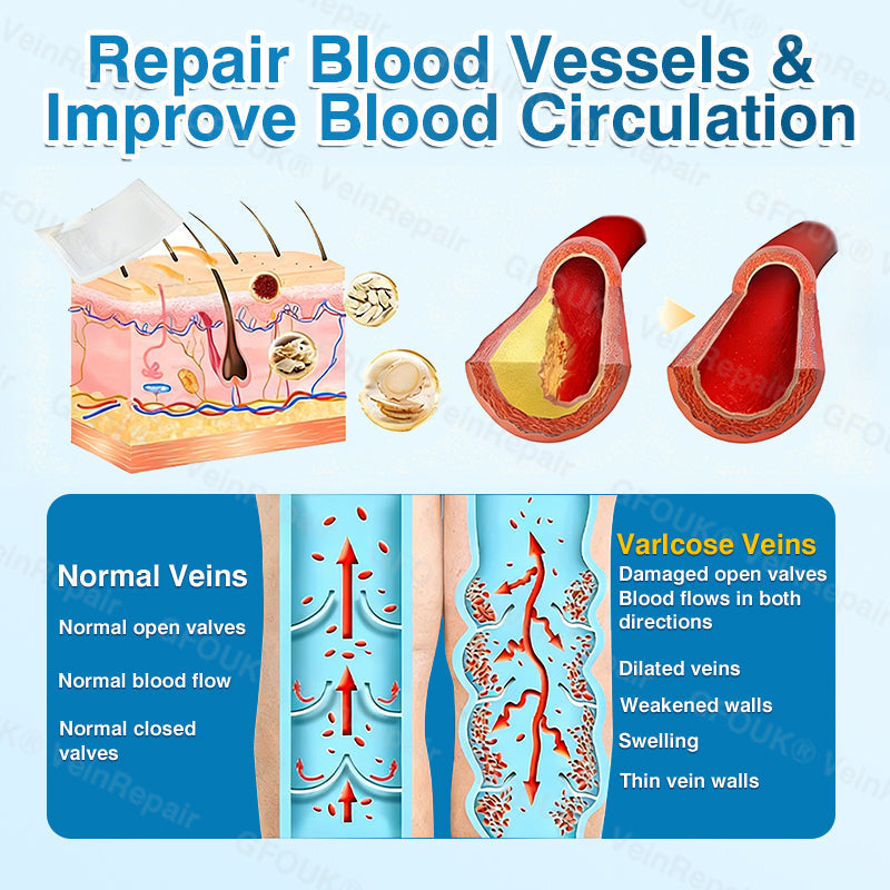 🇬🇧🏆🦵🛡️GFOUK® VeinRepair Microneedle Patch Roll👻Instant Relief, Long-Term Results