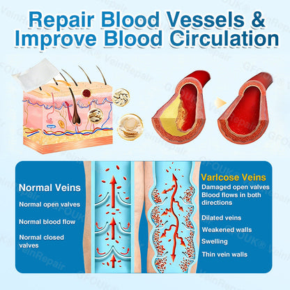 🇬🇧🏆🦵🛡️GFOUK® VeinRepair Microneedle Patch Roll👻Instant Relief, Long-Term Results