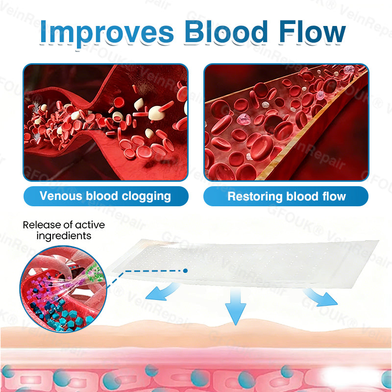 🇬🇧🏆🦵🛡️GFOUK® VeinRepair Microneedle Patch Roll👻Instant Relief, Long-Term Results