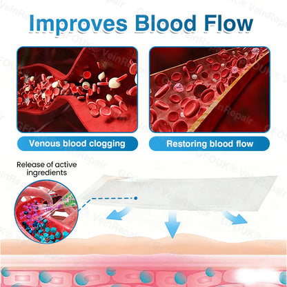 🇬🇧🏆🦵🛡️GFOUK® VeinRepair Microneedle Patch Roll👻Instant Relief, Long-Term Results