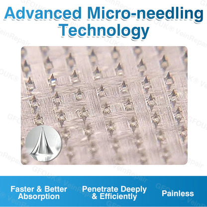 🇬🇧🏆🦵🛡️GFOUK® VeinRepair Microneedle Patch Roll👻Instant Relief, Long-Term Results
