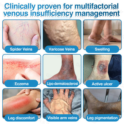 🇬🇧🏆🦵🛡️GFOUK® VeinRepair Microneedle Patch Roll👻Instant Relief, Long-Term Results
